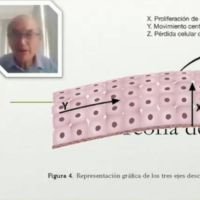 Insuficiencia Limbar Extrema: Pasado, Presente y Futuro