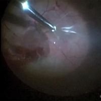 Que no hacer en un TX con CEIO