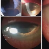 Mi mejor caso y mi peor caso