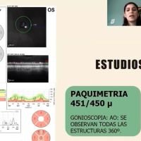 Además de la catarata...