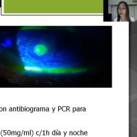 Queratitis Micótica