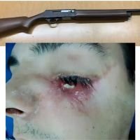 Recontruyendo lo recontruído