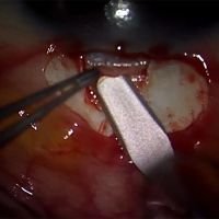 TTT: tips de trabe para todos