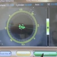 Aberrometria Intraoperatoria