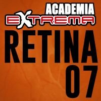 Manejo de Vitreo Anterior en Cataratas Complicadas