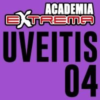 Uveitis 4