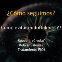 Válvulas Expuestas, Ojo Único